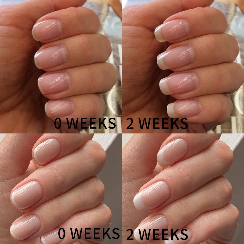 AMORIE - Nail Growth Oil for Strength and Moisture