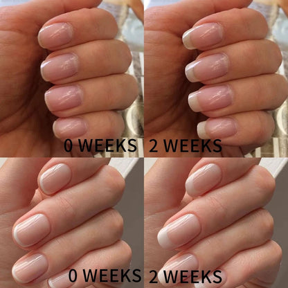 AMORIE - Nail Growth Oil for Strength and Moisture