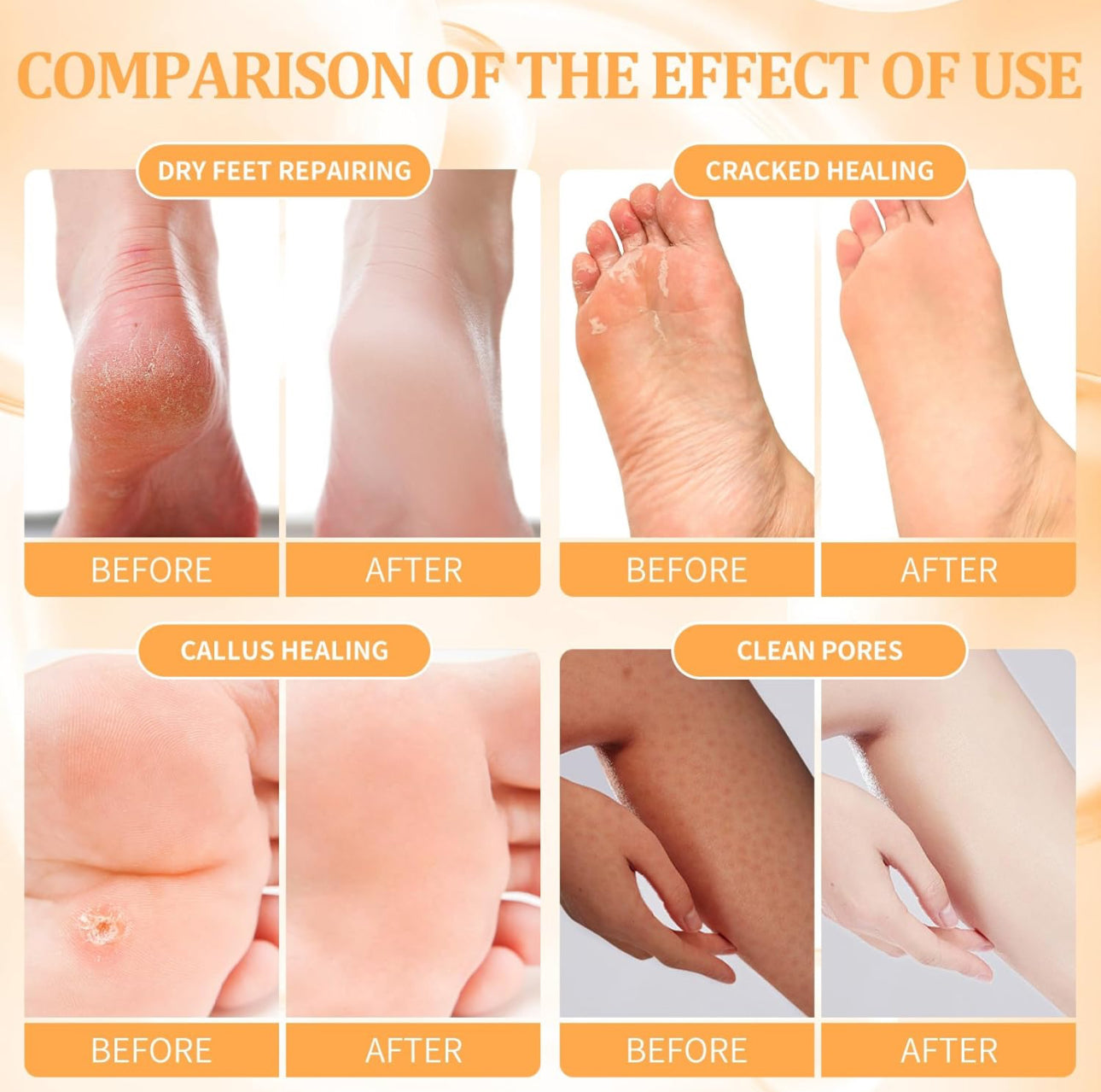 NBC Beautilab Deluxe Pedicure Kit “Orange “